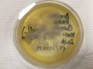 Crecimiento de diferentes tipos o especies de microorganismos