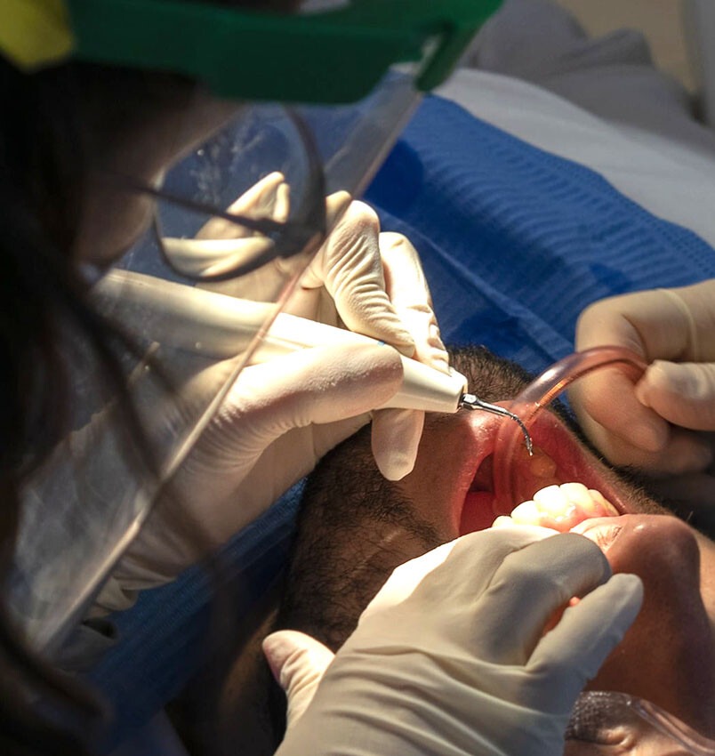 Higiene bucodental, limpieza o tartrectomía