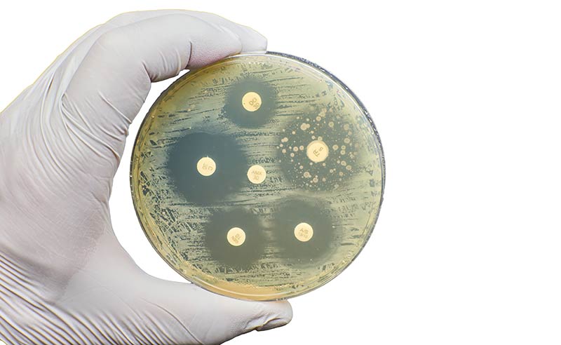 Antibiograma: qué es y cómo se interpreta