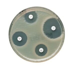 • Difusión en disco: Consiste en colocar discos impregnados con antibióticos sobre una placa de agar sembrada con el microorganismo. Tras la incubación, se observa si hay zonas de inhibición del crecimiento alrededor de los discos, que son claros donde no hay bacterias. 