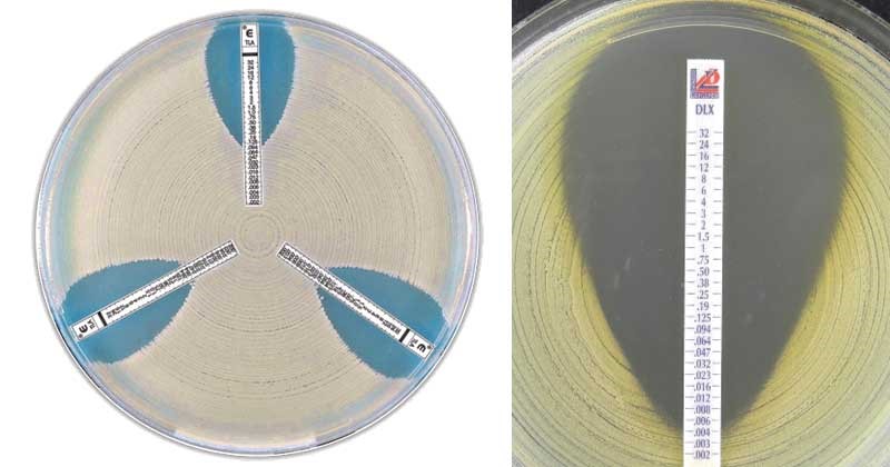 • E-test: Una tira con un gradiente de concentración del antibiótico se coloca sobre la placa, y la intersección del crecimiento bacteriano con la tira indica la CMI.
